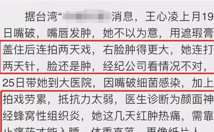 王心凌整容近照认不出 王心凌整容